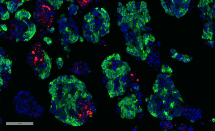 Endocrine and Acinar Cell Composition 