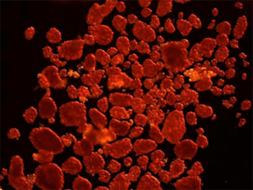 Image of Human Islets from University of Pennsylvania IIC