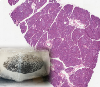 Image of Islets in Ice Cube